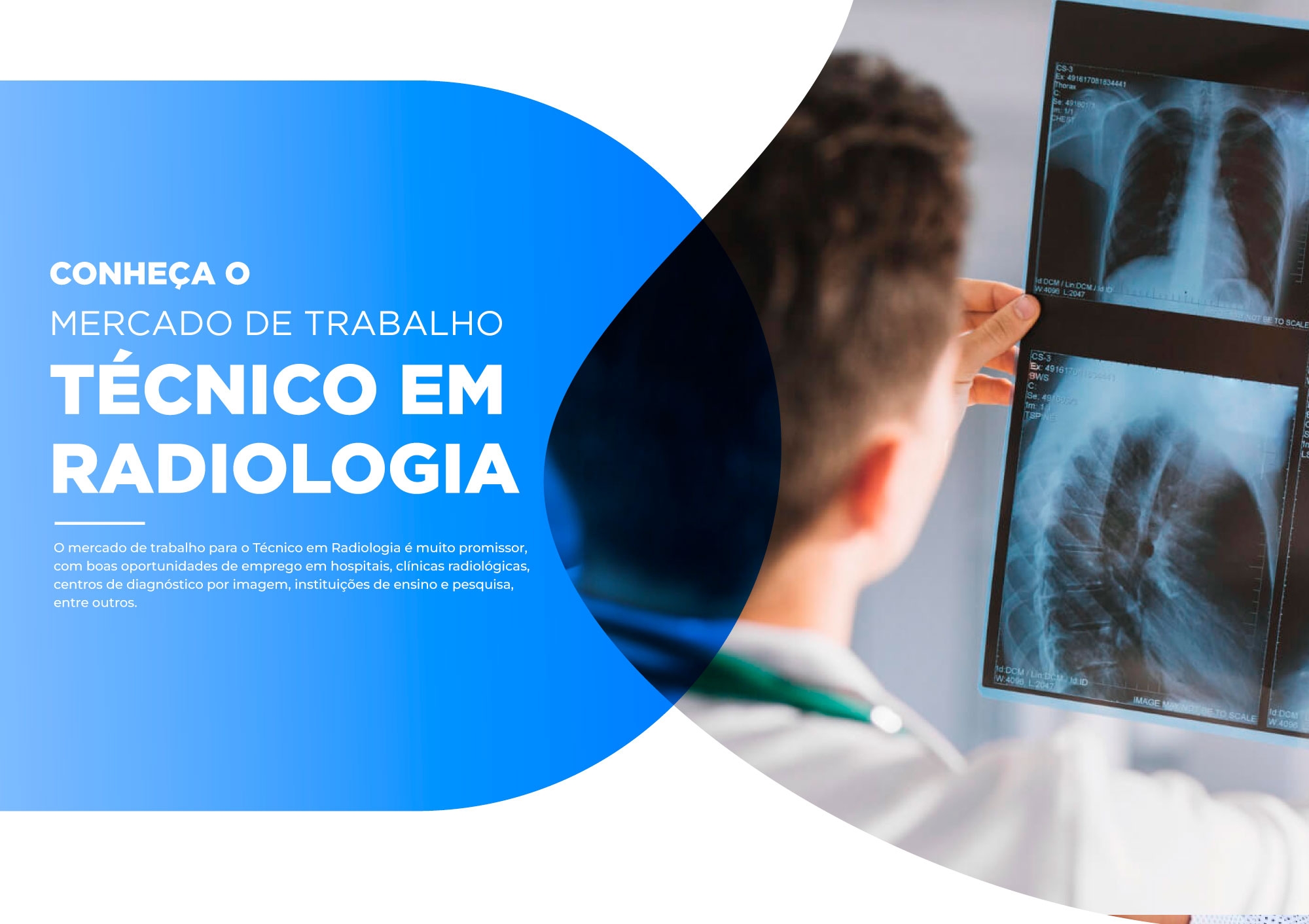 Mercado de Trabalho do Técnico em Radiologia