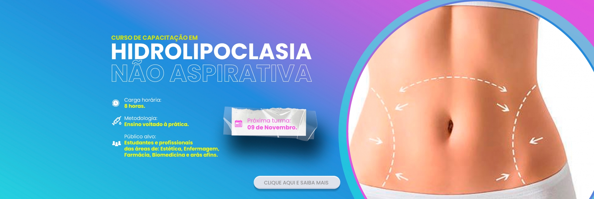 HIDROLIPOCLASIA NÃO ASPIRATIVA