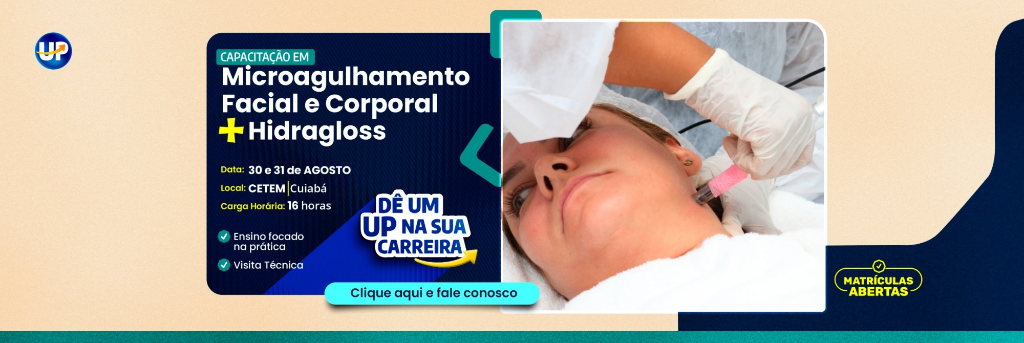 Microagulhamento nas disfunções estéticas