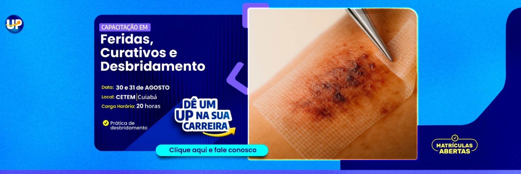 Feridas e Curativos e Desbridamento